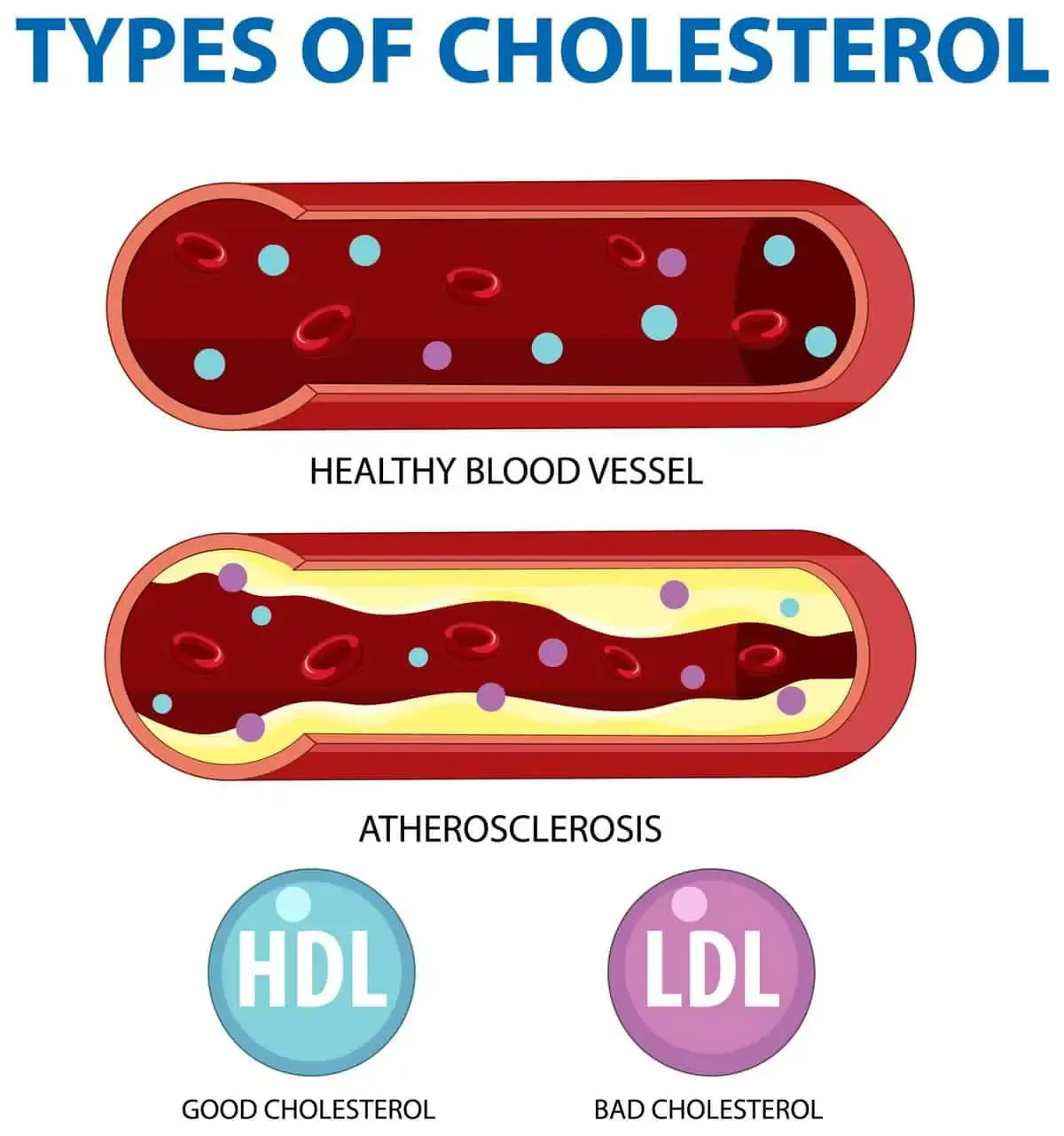 Cholesterol Chaos: The Unexpected Culprits Behind Sudden Spikes