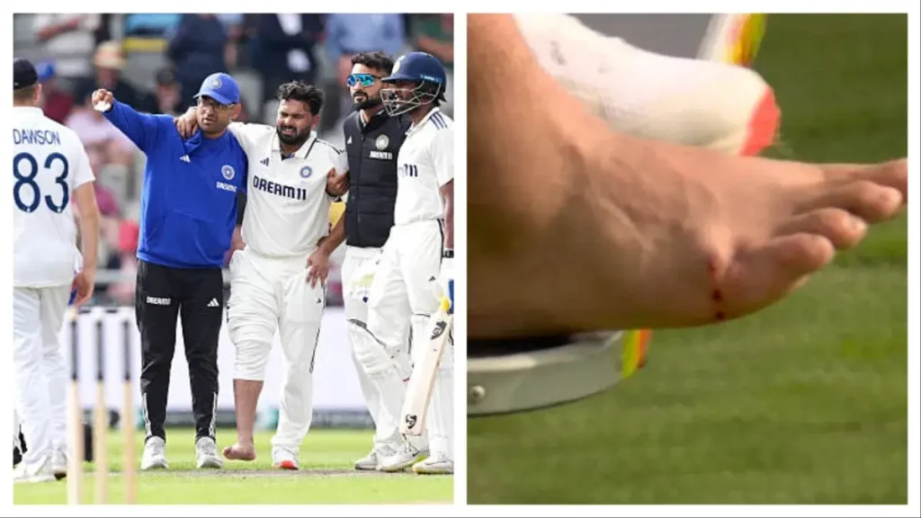 Rishabh Pant Injury Update